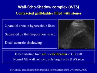 Chronic Cholecystitis Ultrasound Wes Sign