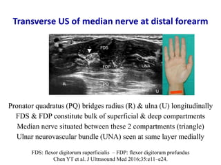 Ultrasound of carpal tunnel syndrome | PPTX