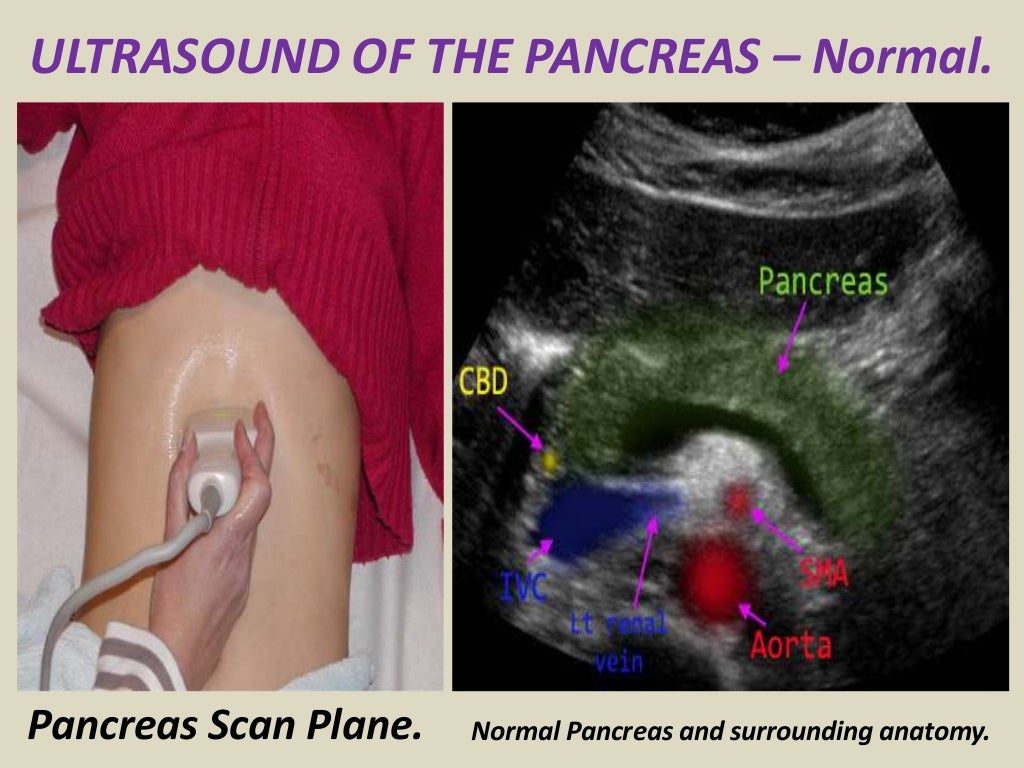 Ultrasound of pancrease in Radiology