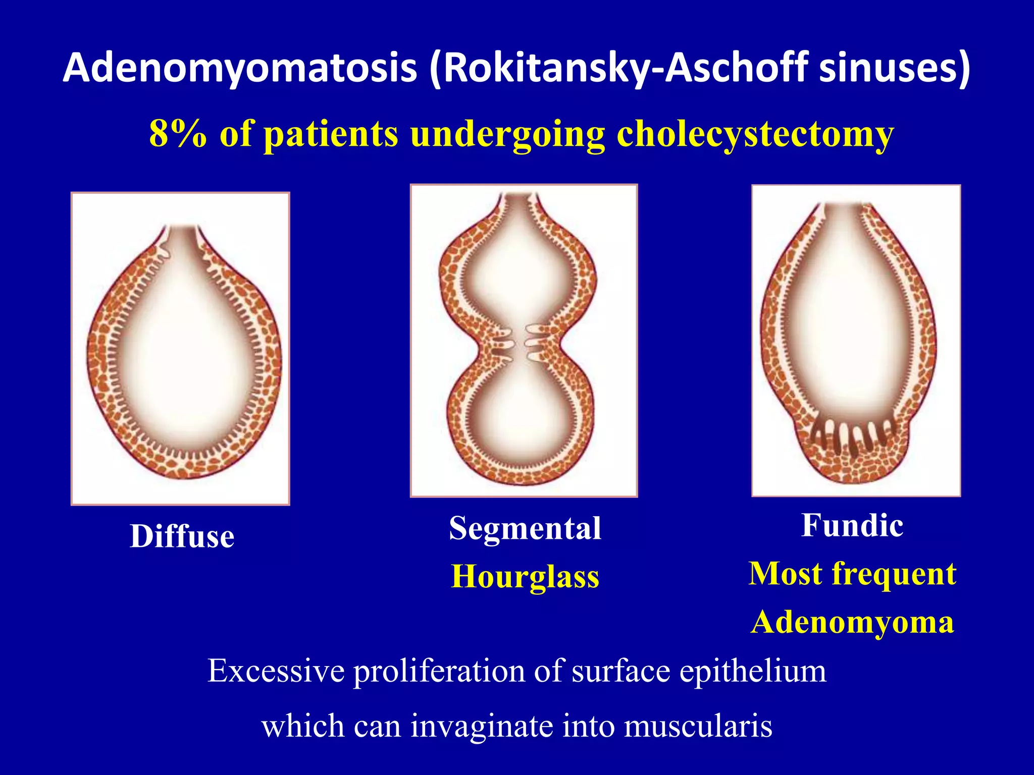 Ultrasound Of The Gallbladder PPTX