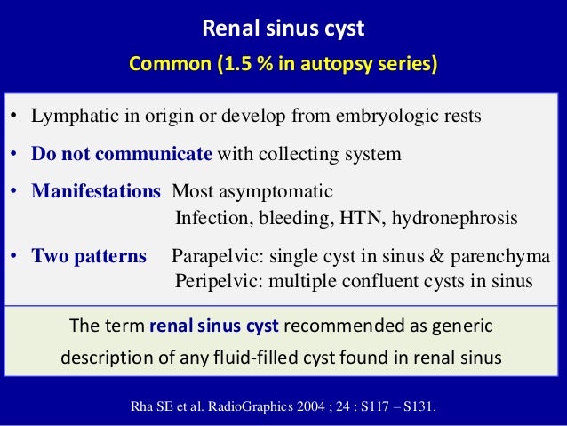 Ultrasound of the urinary tract - Renal cysts