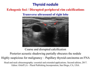 Ultrasound Of Thyroid Nodules PPTX ultrasound-of-thyroid-nodules-pptx