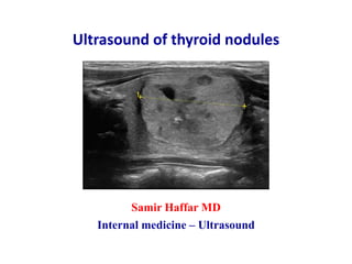 Ultrasound of thyroid nodules
Samir Haffar MD
Internal medicine – Ultrasound
 
