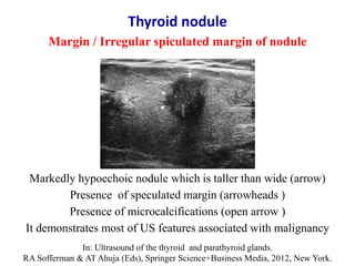 Markedly hypoechoic nodule which is taller than wide (arrow)
Presence of speculated margin (arrowheads )
Presence of micro...