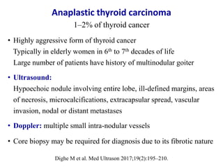 • Highly aggressive form of thyroid cancer
Typically in elderly women in 6th to 7th decades of life
Large number of patien...