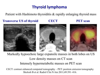 CECT: contrast enhanced computed tomography – PET: positron emission tomography
Sholosh B et al. Radiol Clin N Am 2011;49:...
