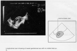 ultra sound O&Gy guide.ppt