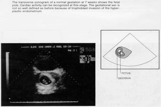 ultra sound O&Gy guide.ppt
