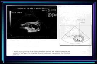 ultra sound O&Gy guide.ppt
