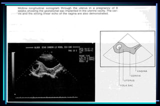 ultra sound O&Gy guide.ppt