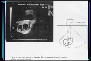 ultra sound O&Gy guide.ppt