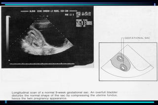 ultra sound O&Gy guide.ppt