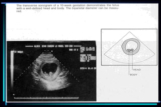 ultra sound O&Gy guide.ppt