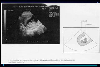 ultra sound O&Gy guide.ppt