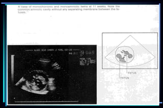 ultra sound O&Gy guide.ppt