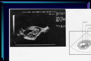 ultra sound O&Gy guide.ppt