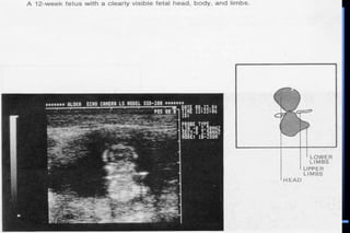 ultra sound O&Gy guide.ppt