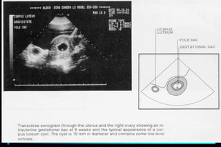 ultra sound O&Gy guide.ppt