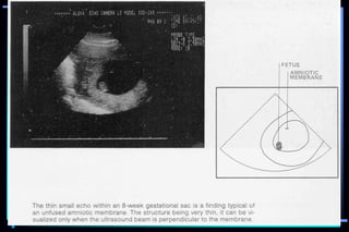 ultra sound O&Gy guide.ppt