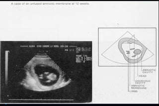 ultra sound O&Gy guide.ppt