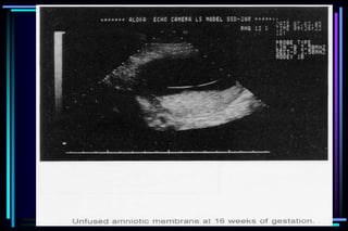 ultra sound O&Gy guide.ppt
