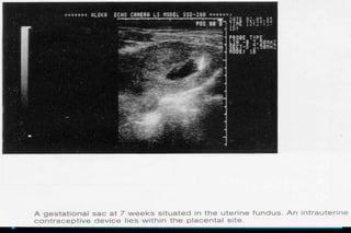 ultra sound O&Gy guide.ppt