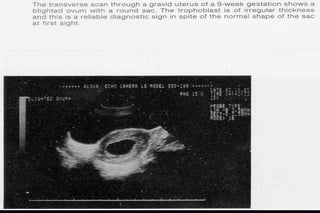 ultra sound O&Gy guide.ppt