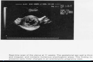 ultra sound O&Gy guide.ppt