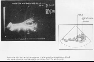 ultra sound O&Gy guide.ppt