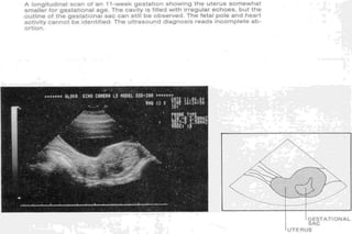 ultra sound O&Gy guide.ppt