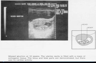 ultra sound O&Gy guide.ppt