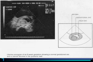 ultra sound O&Gy guide.ppt