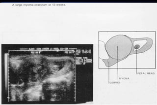 ultra sound O&Gy guide.ppt