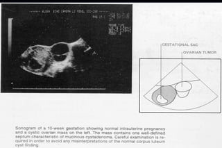 ultra sound O&Gy guide.ppt