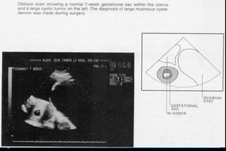 ultra sound O&Gy guide.ppt