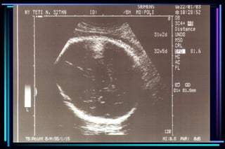 ultra sound O&Gy guide.ppt