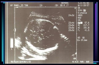 ultra sound O&Gy guide.ppt