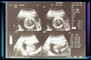 ultra sound O&Gy guide.ppt