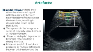 Comprehensive Overview of Ultrasound Physics and Grey Scale Imaging in ...