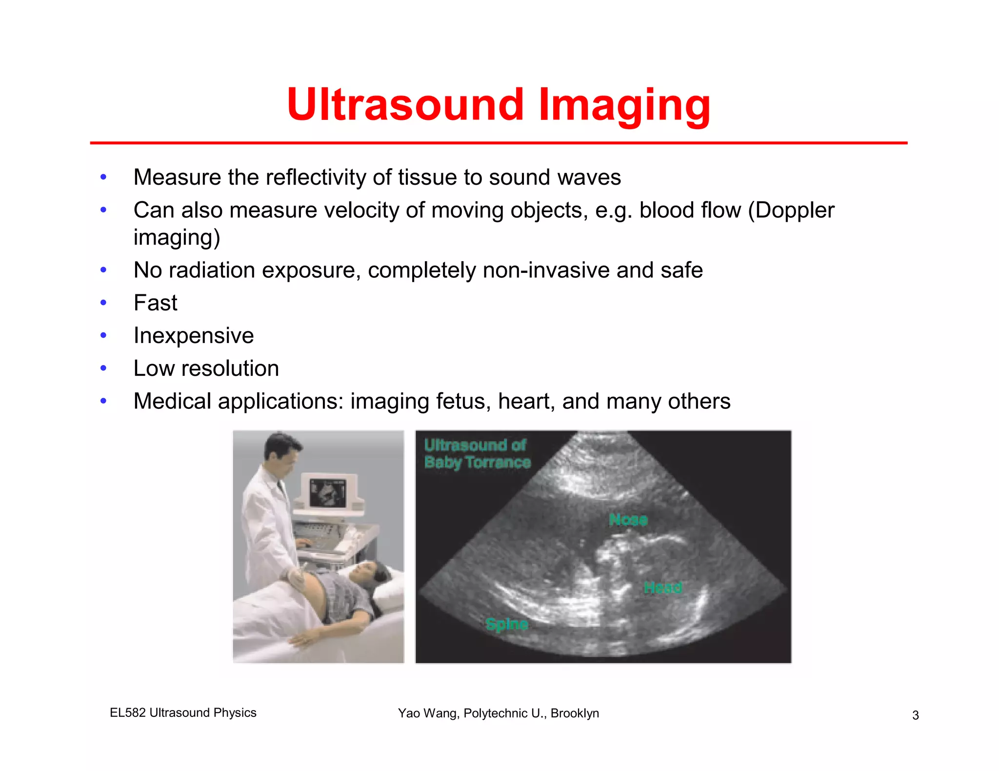 Ultrasound Imaging
•      Measure the reflectivity of tissue to sound waves
•      Can also measure velocity of moving objects, e.g. blood flow (Doppler
       imaging)
•      No radiation exposure, completely non-invasive and safe
•      Fast
•      Inexpensive
•      Low resolution
•      Medical applications: imaging fetus, heart, and many others




    EL582 Ultrasound Physics       Yao Wang, Polytechnic U., Brooklyn          3
 