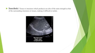 Ultra sound physics CMU.pptx