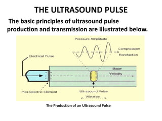 THE ULTRASOUND PULSE
The basic principles of ultrasound pulse
production and transmission are illustrated below.
The Produ...