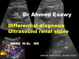 Ultrasound renal stone differential diagnosis .