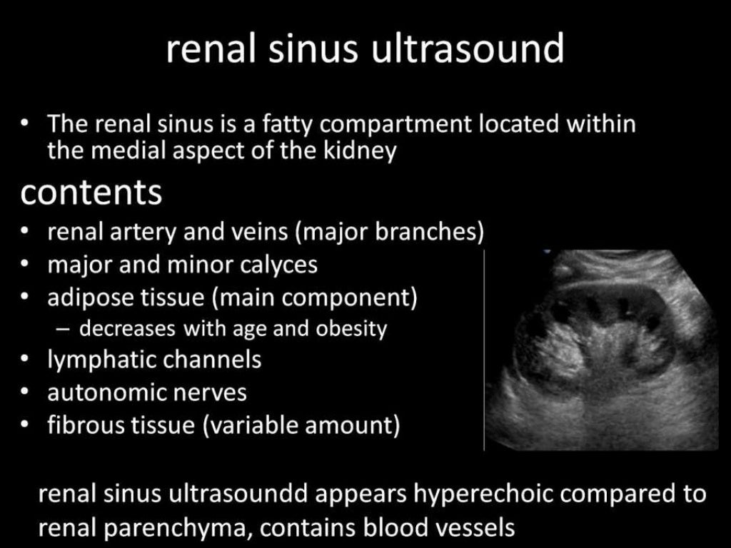 Ultrasound renal stone differential diagnosis