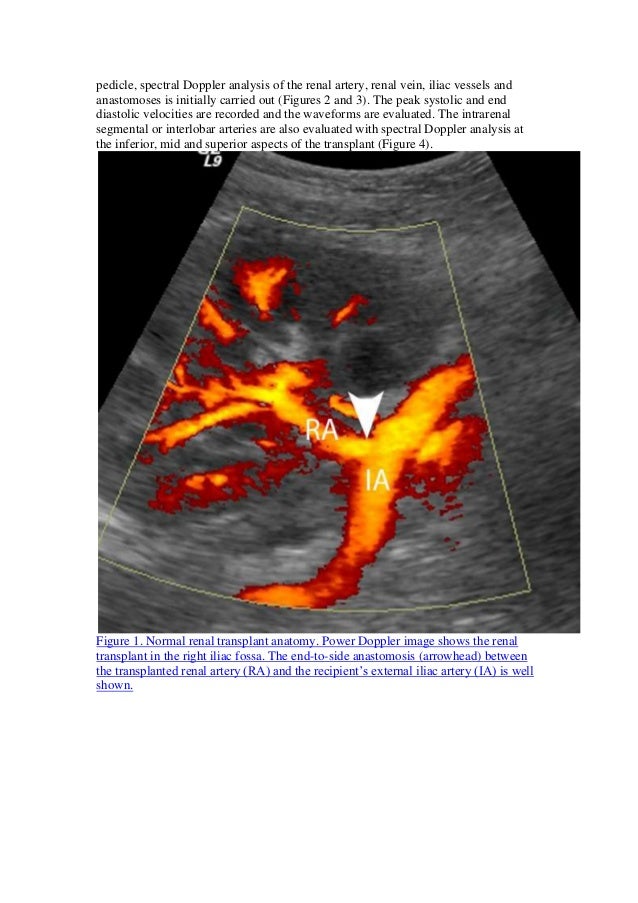 Ultrasound renal transplant diagram of normal kidney 