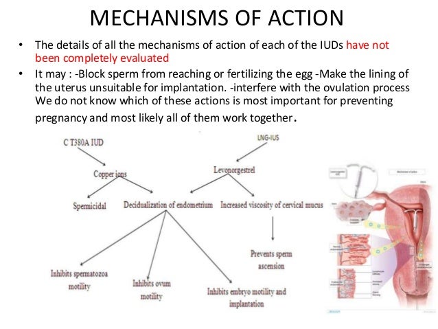 role of ultrasound in assessment of iucd