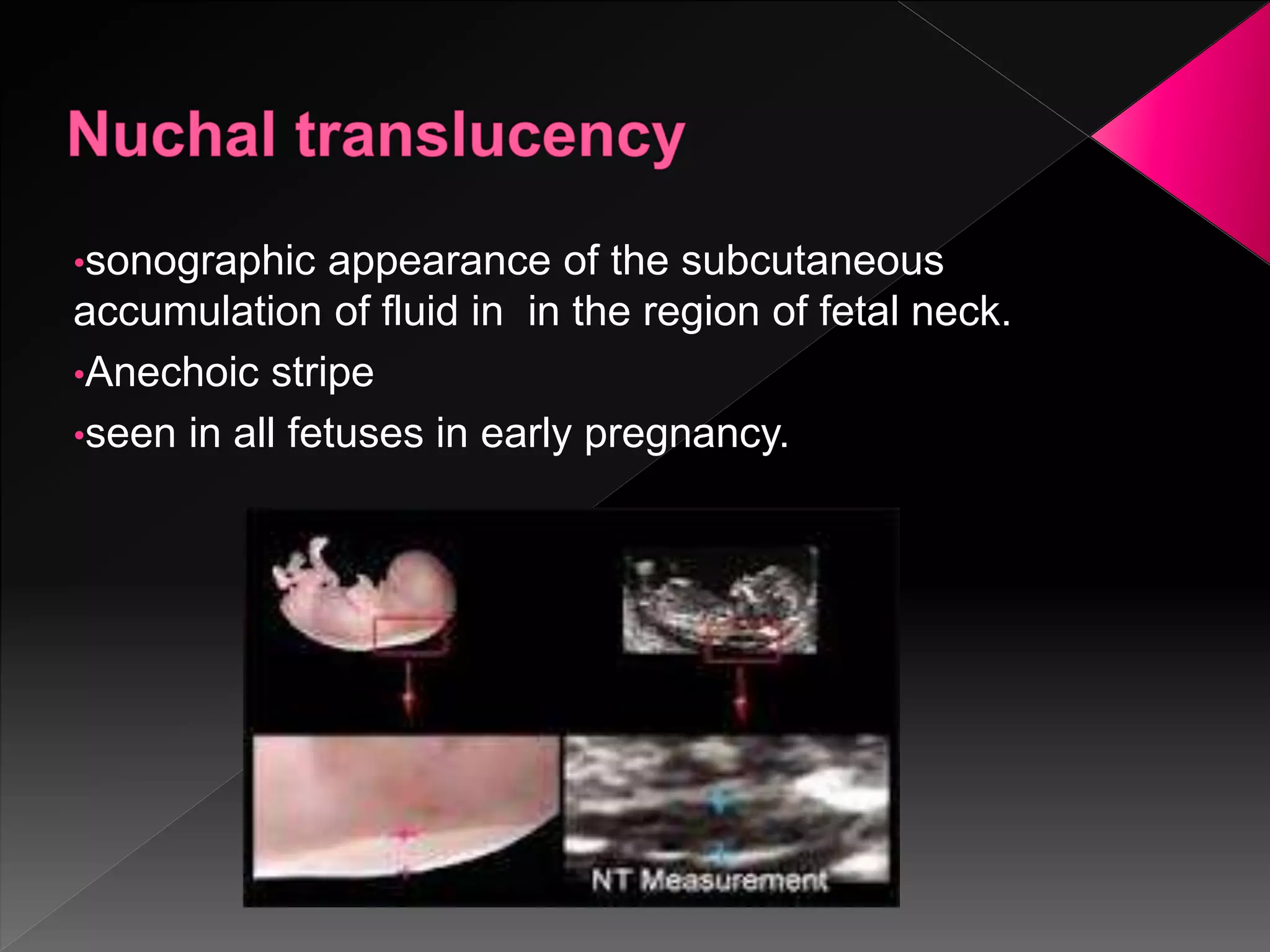 Ultrasound in obstetrics | PPTX