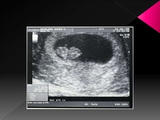 Ultrasound in obstetrics | PPTX