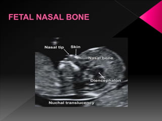 Ultrasound in obstetrics | PPTX
