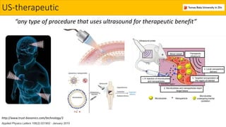 Ultrasound triggered release of anticancer agents from alginate ...